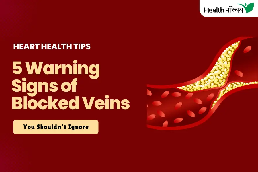 5 Warning Signs of Blocked Veins You Shouldn’t Ignore