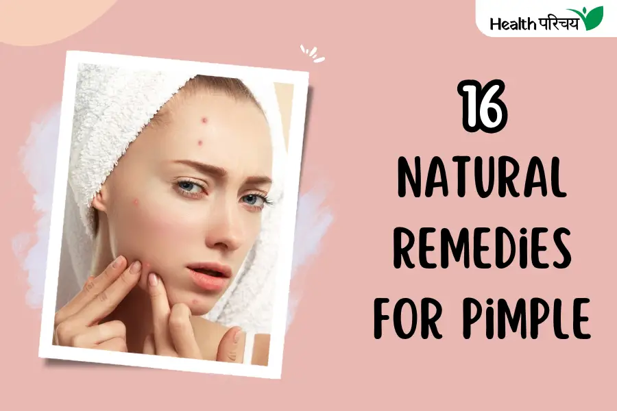 16 Natural Remedies for Pimple