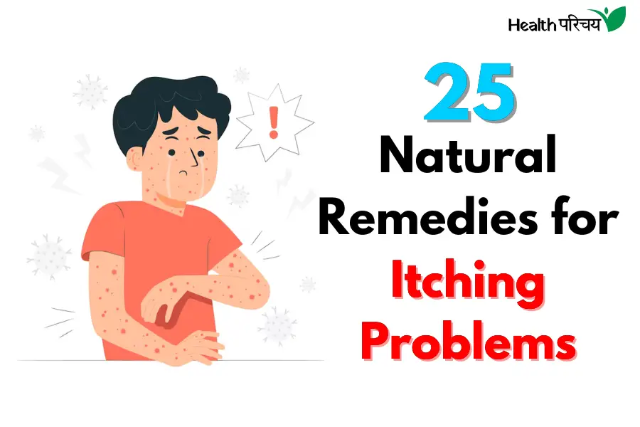 25 Home Remedies for Itching Problems