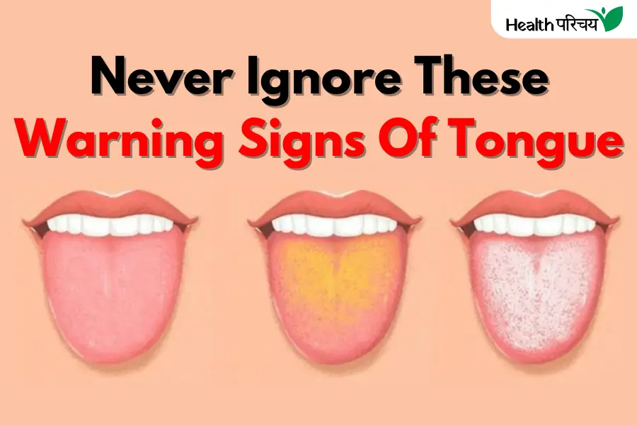 7 Warning Signs Your Tongue Is Telling You About Your Health